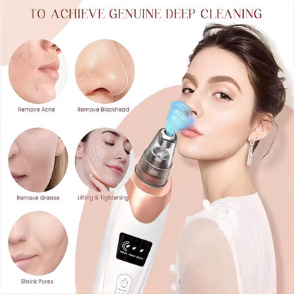 Blackhead Remover Vacuum